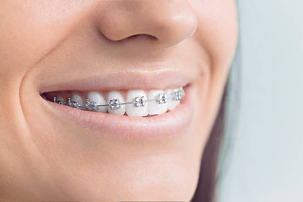 Best Veneers and Lumineers  in Bedminster, NJ